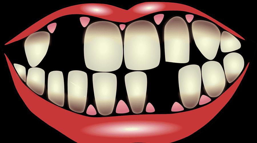 Видеть во сне выпадение зубов без крови. К чему снятся выпадающие без крови зубы? Что значит, если выпал зуб без крови: верхний, нижний, коренной, передний