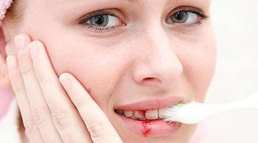 Сон про зубы с кровью. Во сне выпадают зубы к чему это снится. Сон про зубы с кровью. Десневые кровотечения. Сон про зубы с кровью.